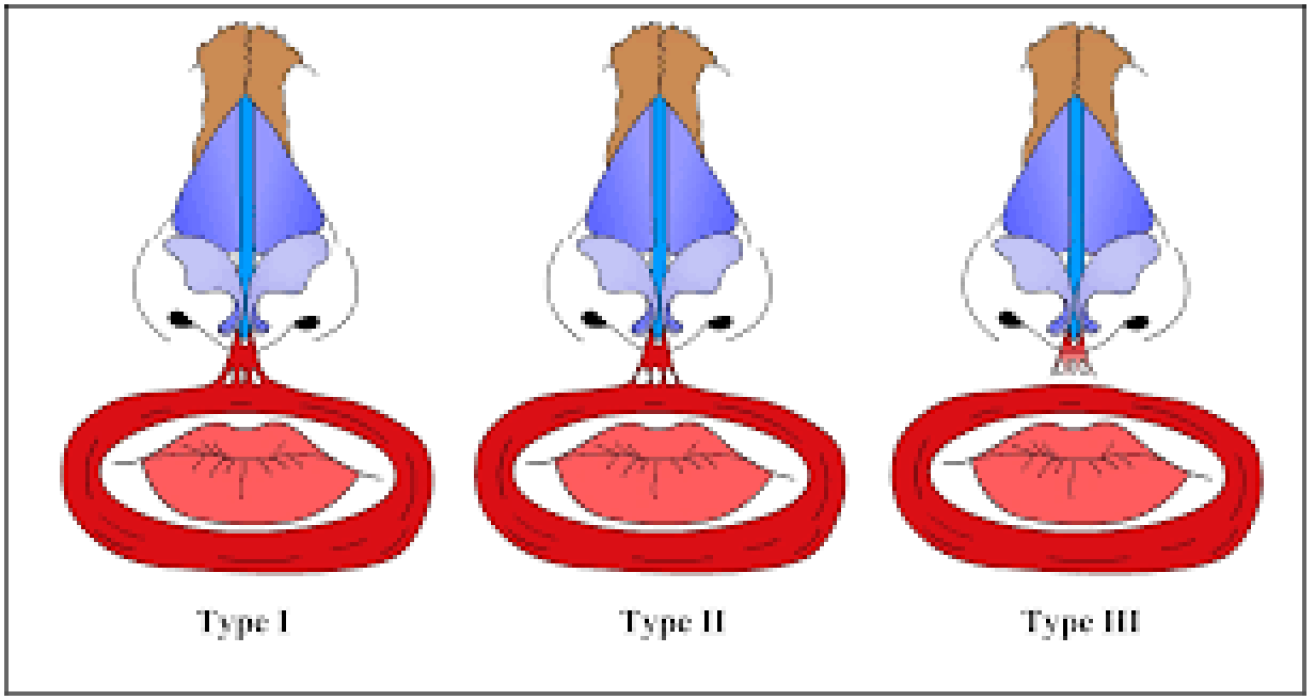 Rohrich Nasal Anatomy